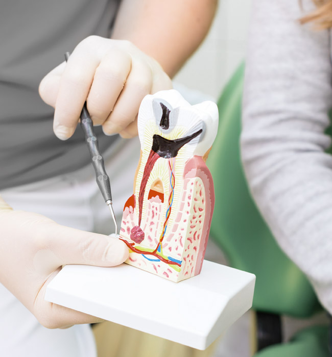 Wurzelkanallängenbestimmung bei Ihrem Zahnarzt in Marxheim